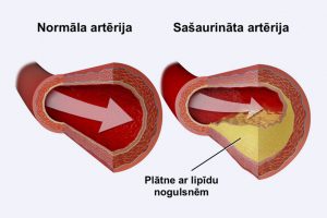 asinsvads_LV